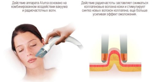 Действие косметологического аппарата Aluma